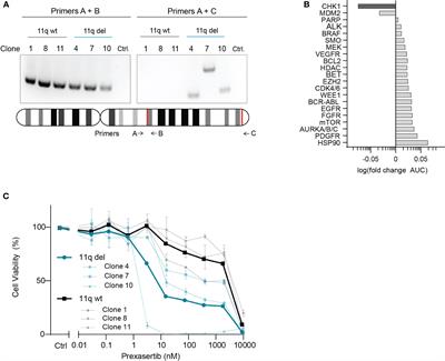 Chromosome 11q loss and MYCN amplification demonstrate synthetic lethality with checkpoint kinase 1 inhibition in neuroblastoma